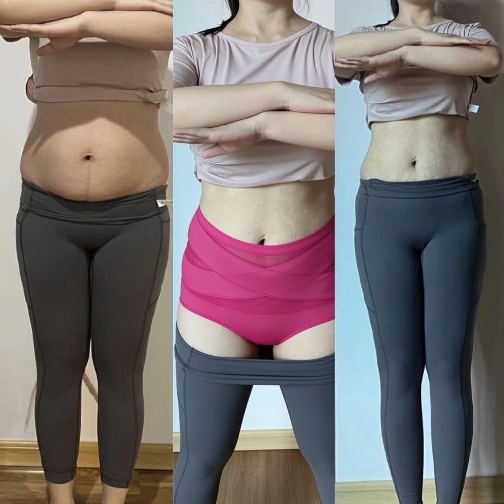 Customer photo review of Bremaris™ Faja Moldeadora