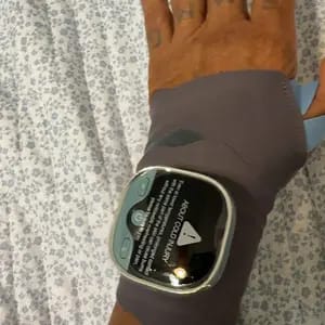 Customer photo review of Sollievo Dal Dolore Massaggiatore Mani Elettrico Con Calore