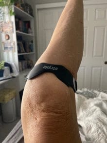 Customer photo review of Adımora Ayarlanabilir Diz Destek Bandı