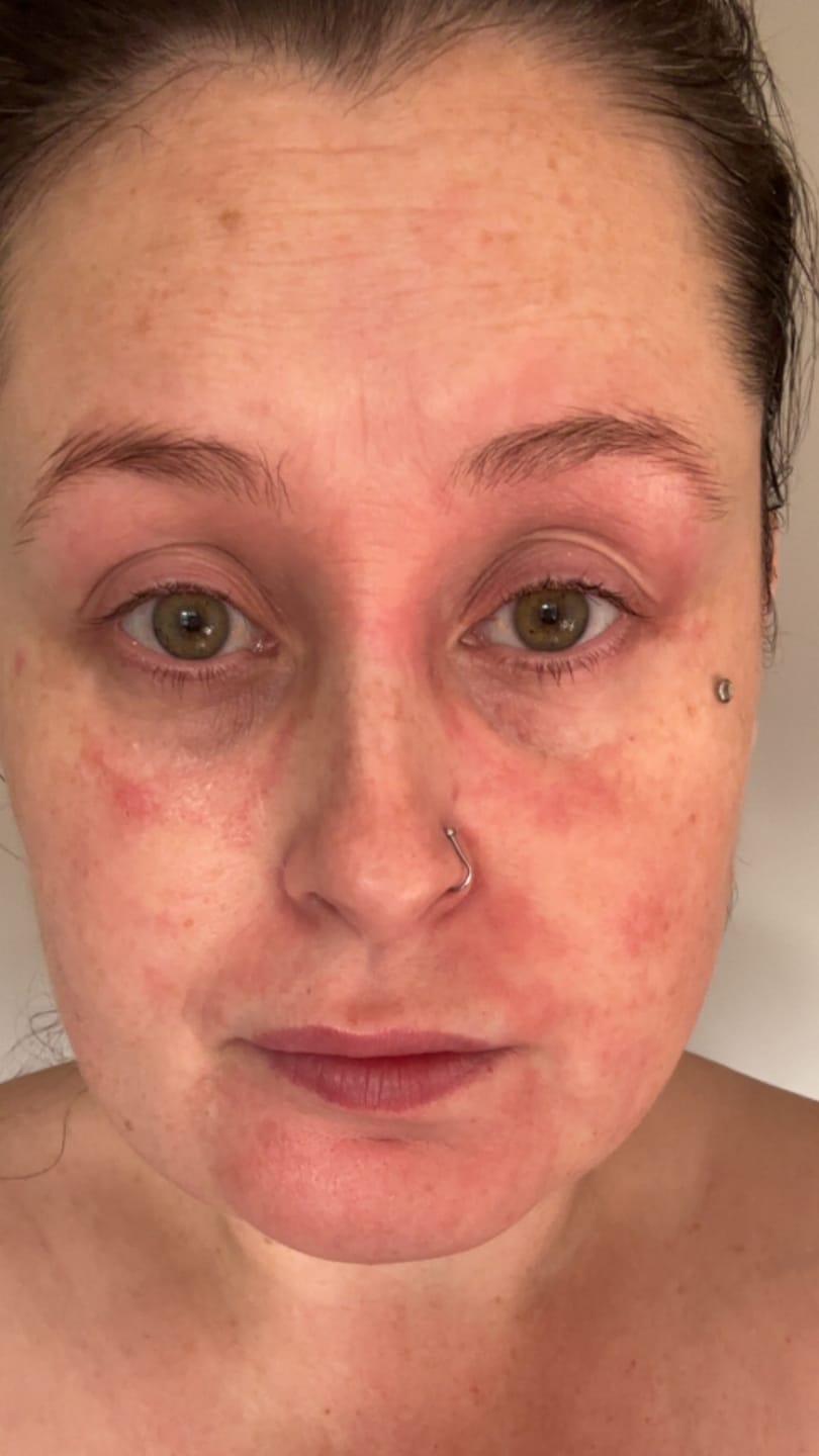 Customer photo review of Calm Balm