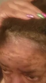 Customer photo review of Capilux™ — Exfoliante para un Cuero Cabelludo Limpio y Calmado