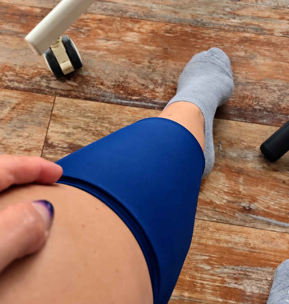 Customer photo review of ThermLox™ Bandage