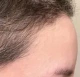 Customer photo review of Capilux™ — Exfoliante para un Cuero Cabelludo Limpio y Calmado
