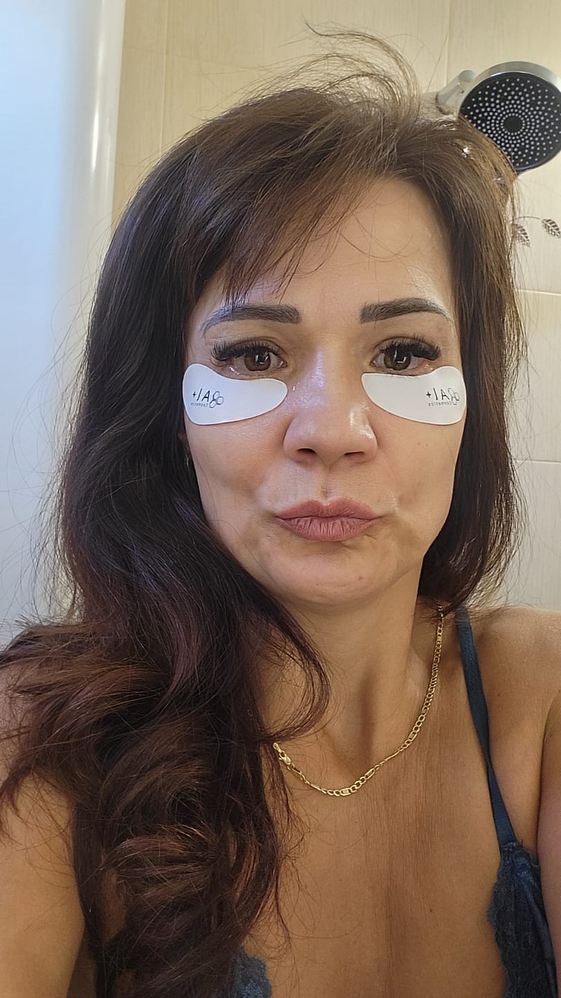 Customer photo review of Eye Revival+ | Рутина за тъмни кръгове, подпухване и фини линии