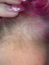 Customer photo review of Capilux™ — Exfoliante para un Cuero Cabelludo Limpio y Calmado