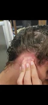 Customer photo review of Capilux™ — Exfoliante para un Cuero Cabelludo Limpio y Calmado