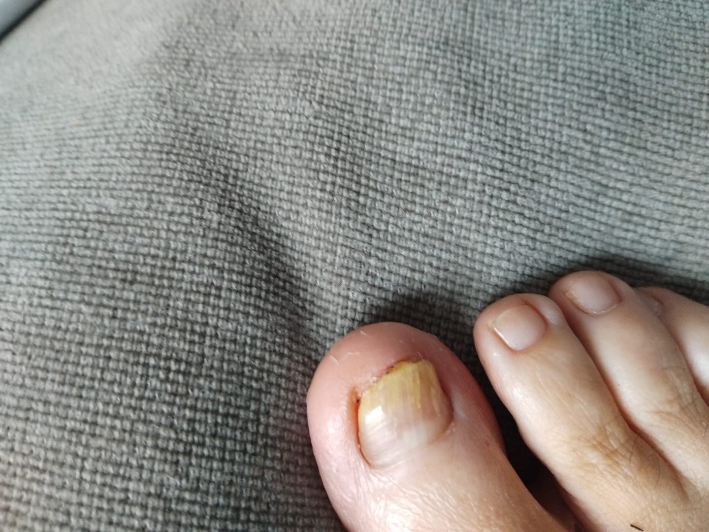 Customer photo review of Fungal Freedom