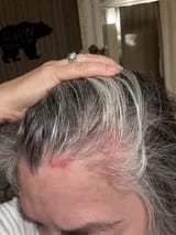 Customer photo review of Capilux™ — Exfoliante para un Cuero Cabelludo Limpio y Calmado