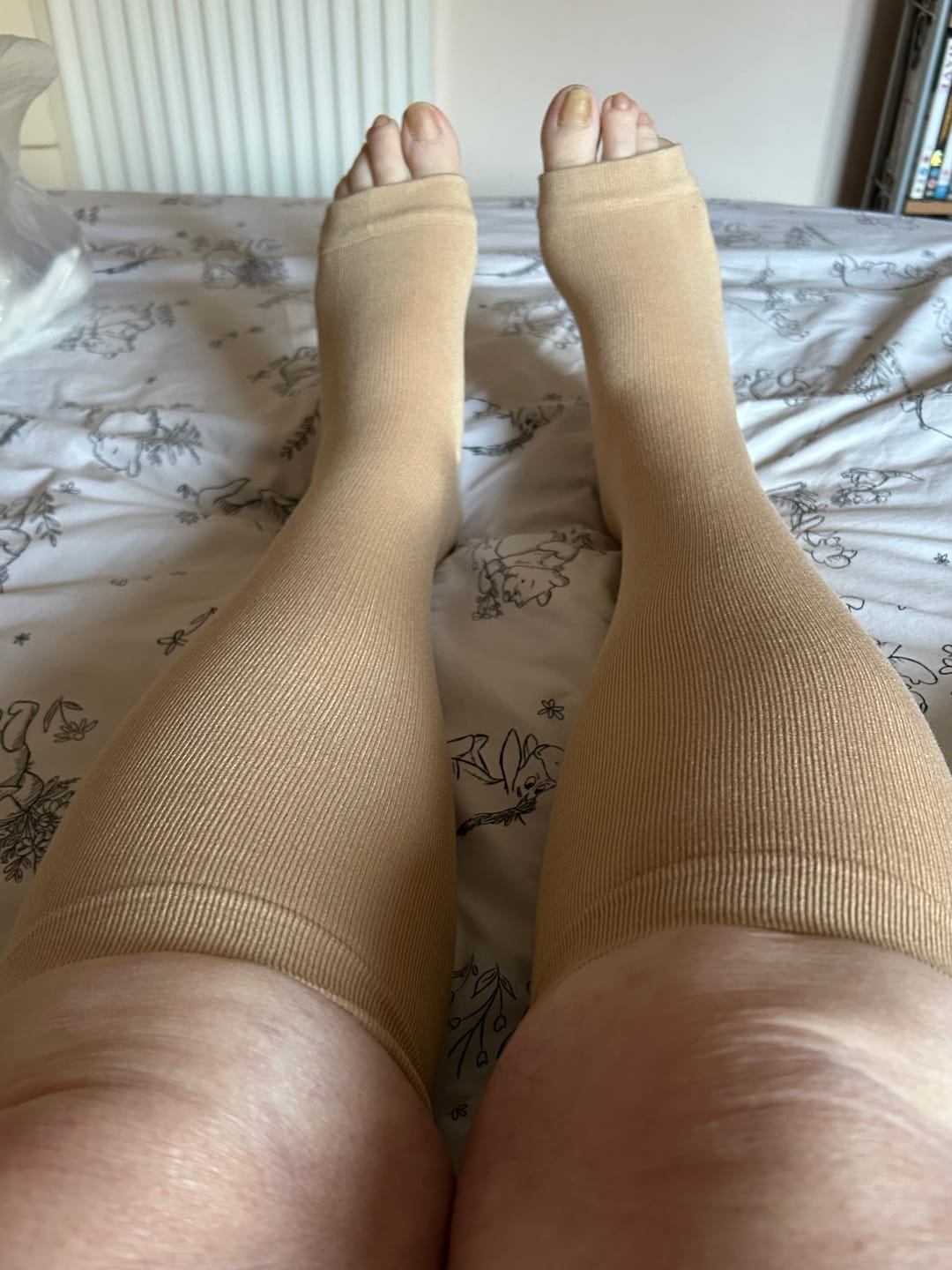Customer photo review of Vsock™ Wide Compression Socks For Pain Relief (Open-Toe)