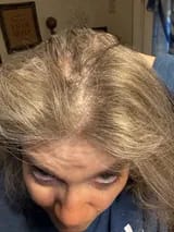 Customer photo review of Capilux™ — Exfoliante para un Cuero Cabelludo Limpio y Calmado