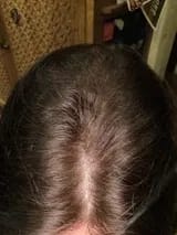 Customer photo review of Capilux™ — Exfoliante para un Cuero Cabelludo Limpio y Calmado