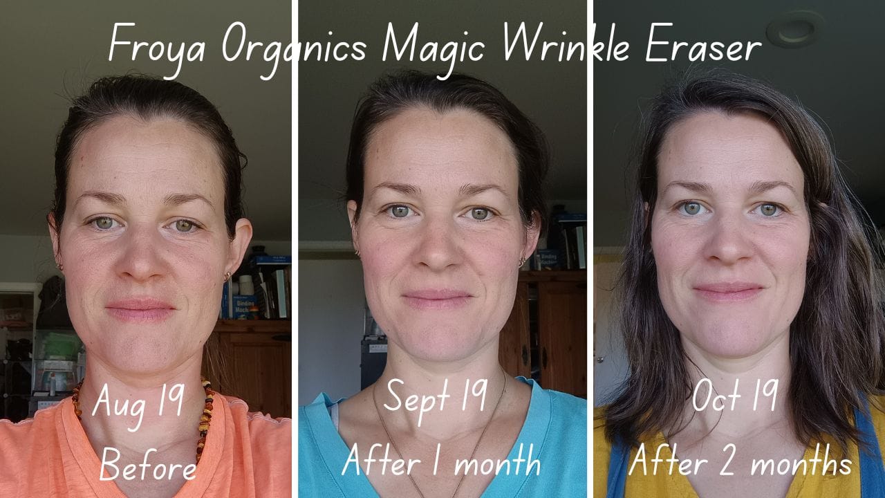 Customer photo review of Wrinkle Smoothing Night Balm