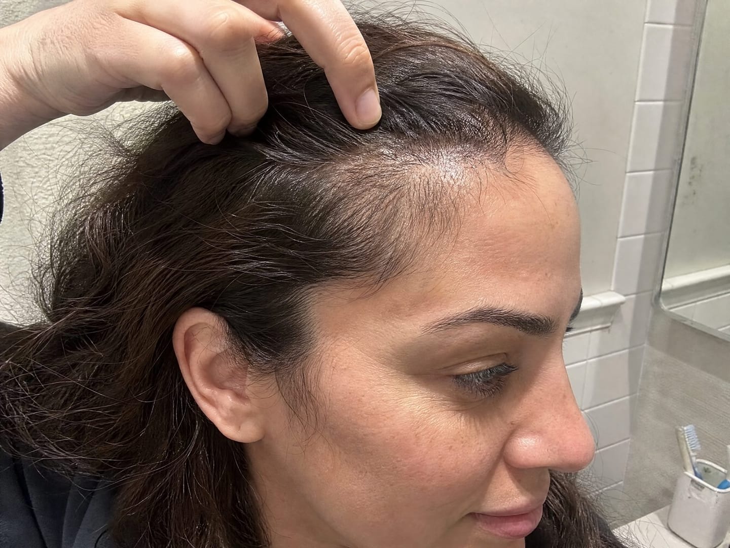 Customer photo review of Pumpkin Seed Oil & Saw Palmetto Hair Renewal Complex