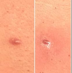 Customer photo review of LumiDew™ Skin Essence