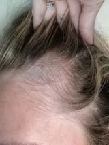 Customer photo review of Capilux™ — Exfoliante para un Cuero Cabelludo Limpio y Calmado