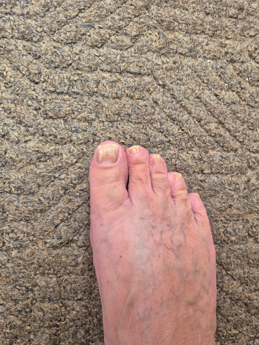 Customer photo review of Fungal Freedom