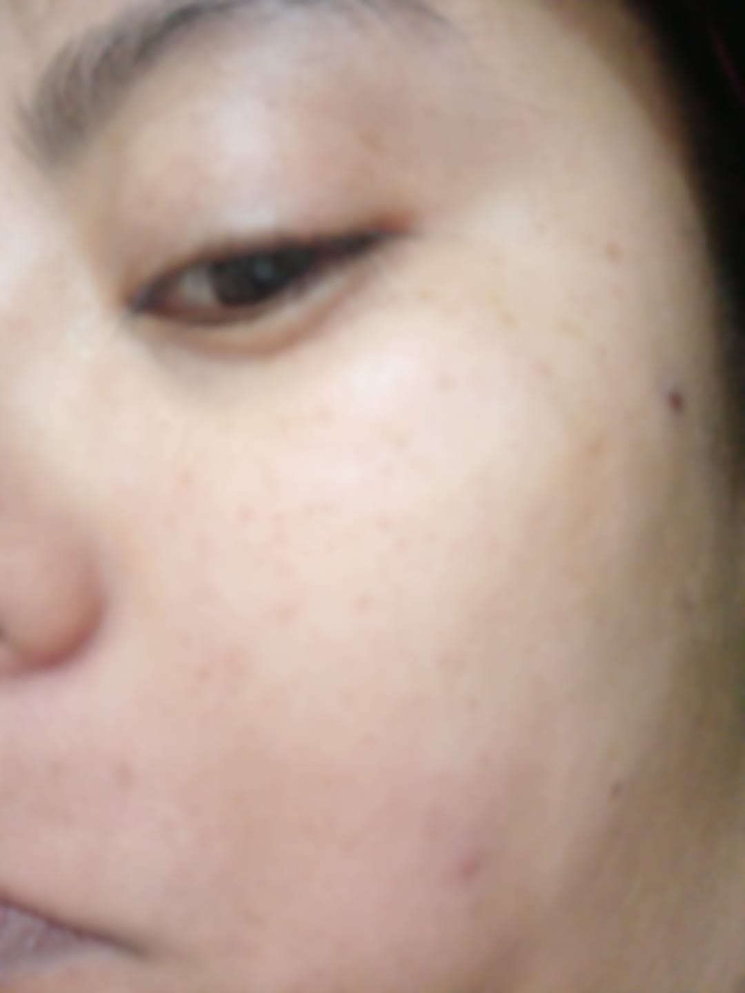 Customer photo review of Gel Crema Calmante y Reparador con CICA y Pantenol