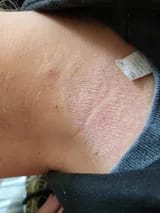 Customer photo review of Capilux™ — Exfoliante para un Cuero Cabelludo Limpio y Calmado