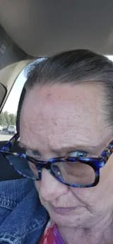 Customer photo review of Capilux™ — Exfoliante para un Cuero Cabelludo Limpio y Calmado