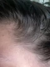 Customer photo review of Capilux™ — Exfoliante para un Cuero Cabelludo Limpio y Calmado