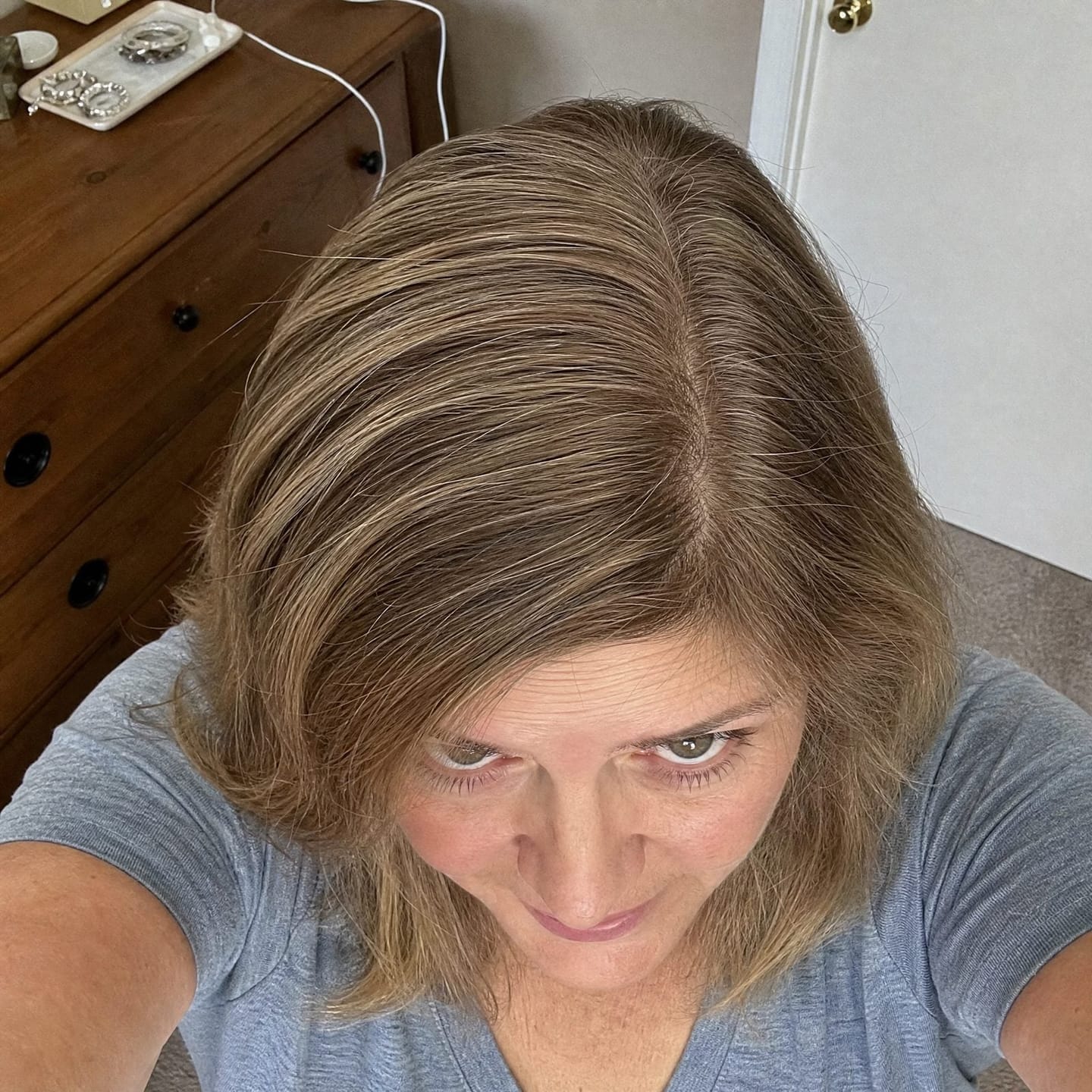 Customer photo review of Pumpkin Seed Oil & Saw Palmetto Hair Renewal Complex