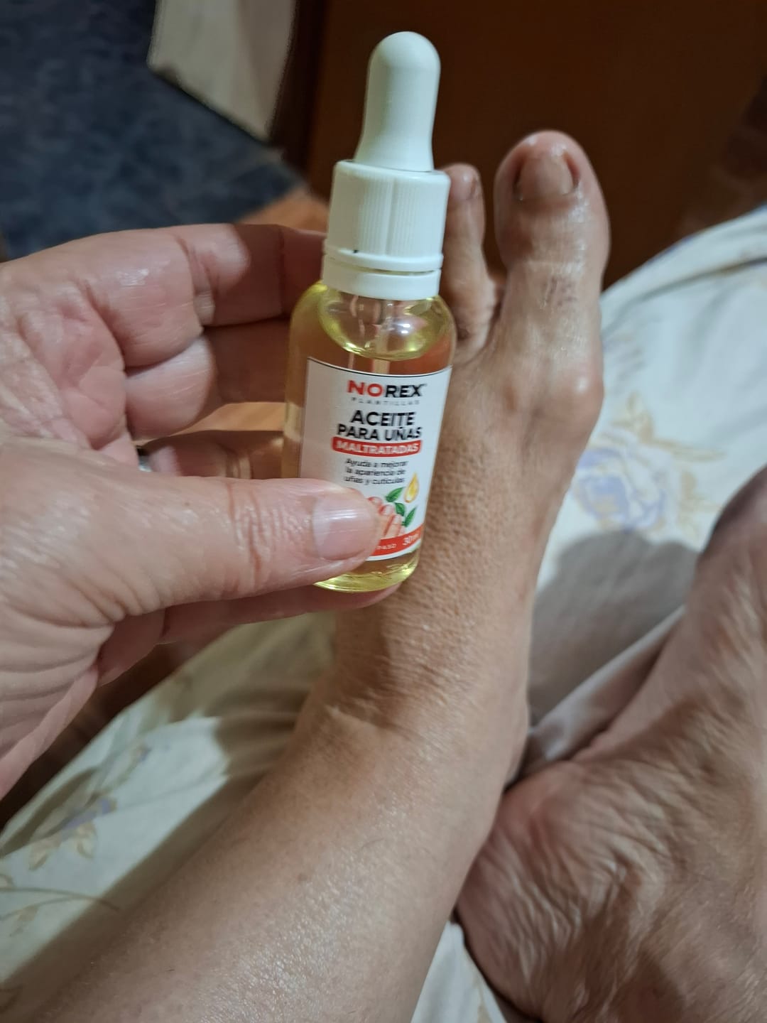 Customer photo review of NOREVEX: El aceite que elimina el 99.9% de los hongos en tus uñas.