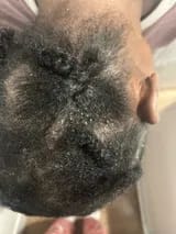 Customer photo review of Capilux™ — Exfoliante para un Cuero Cabelludo Limpio y Calmado