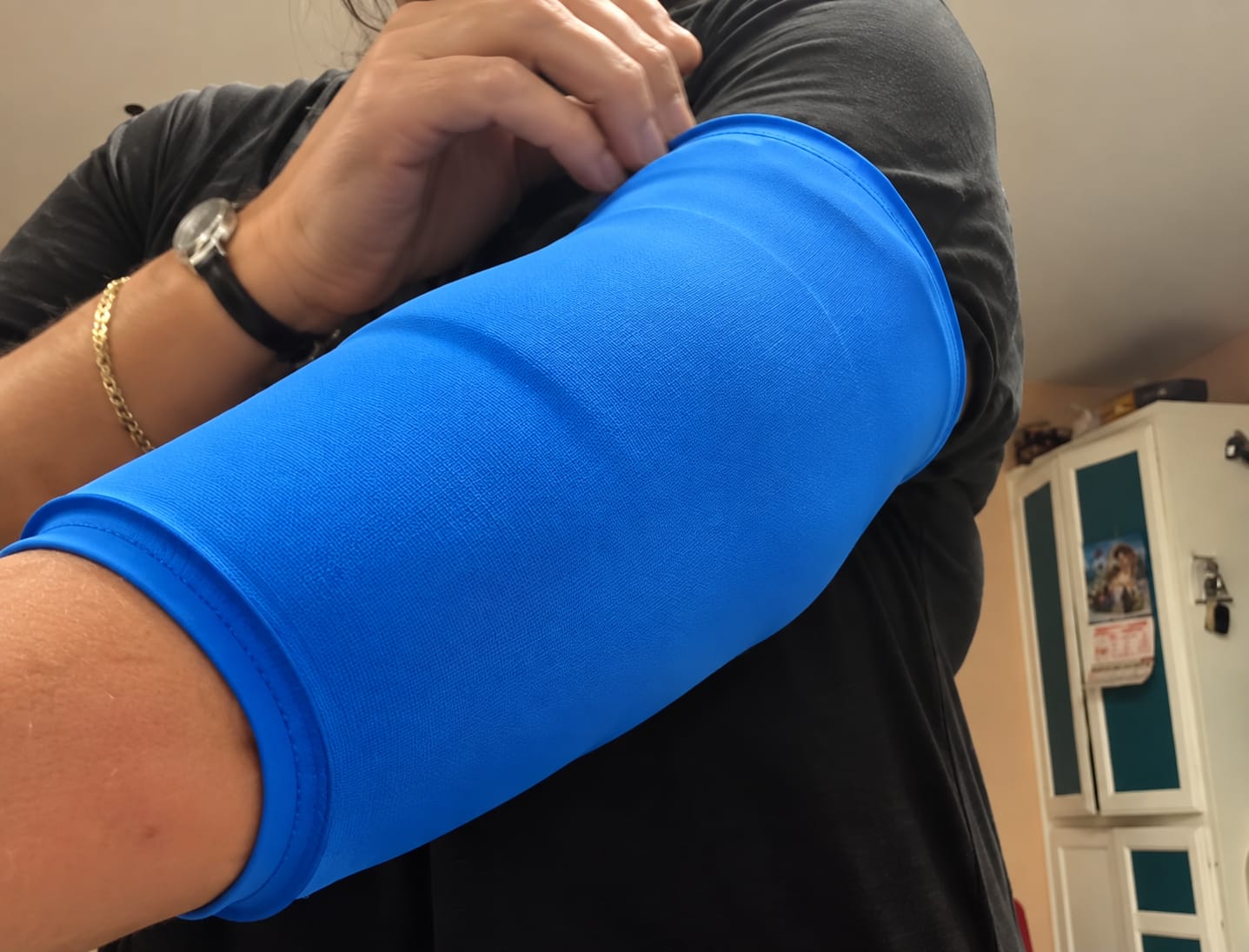 Customer photo review of ThermLox™ Bandage