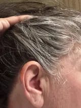 Customer photo review of Capilux™ — Exfoliante para un Cuero Cabelludo Limpio y Calmado