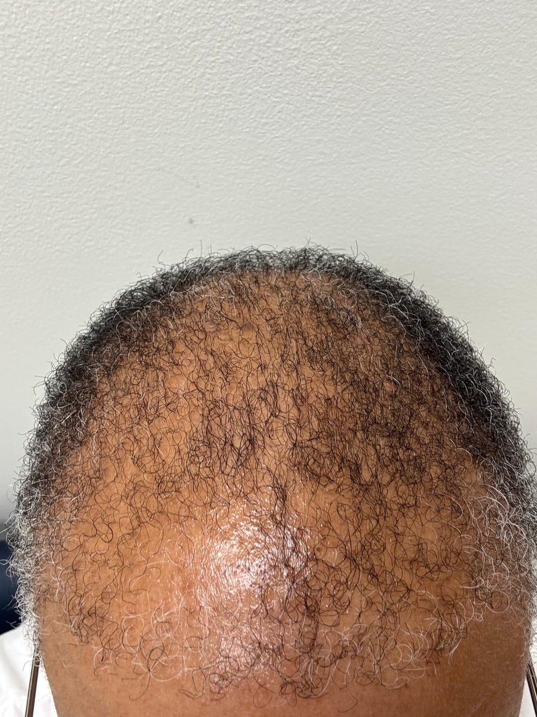 Customer photo review of BALM - Stimulating Scalp & Hair Balm