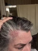 Customer photo review of Capilux™ — Exfoliante para un Cuero Cabelludo Limpio y Calmado