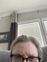 Customer photo review of Capilux™ — Exfoliante para un Cuero Cabelludo Limpio y Calmado