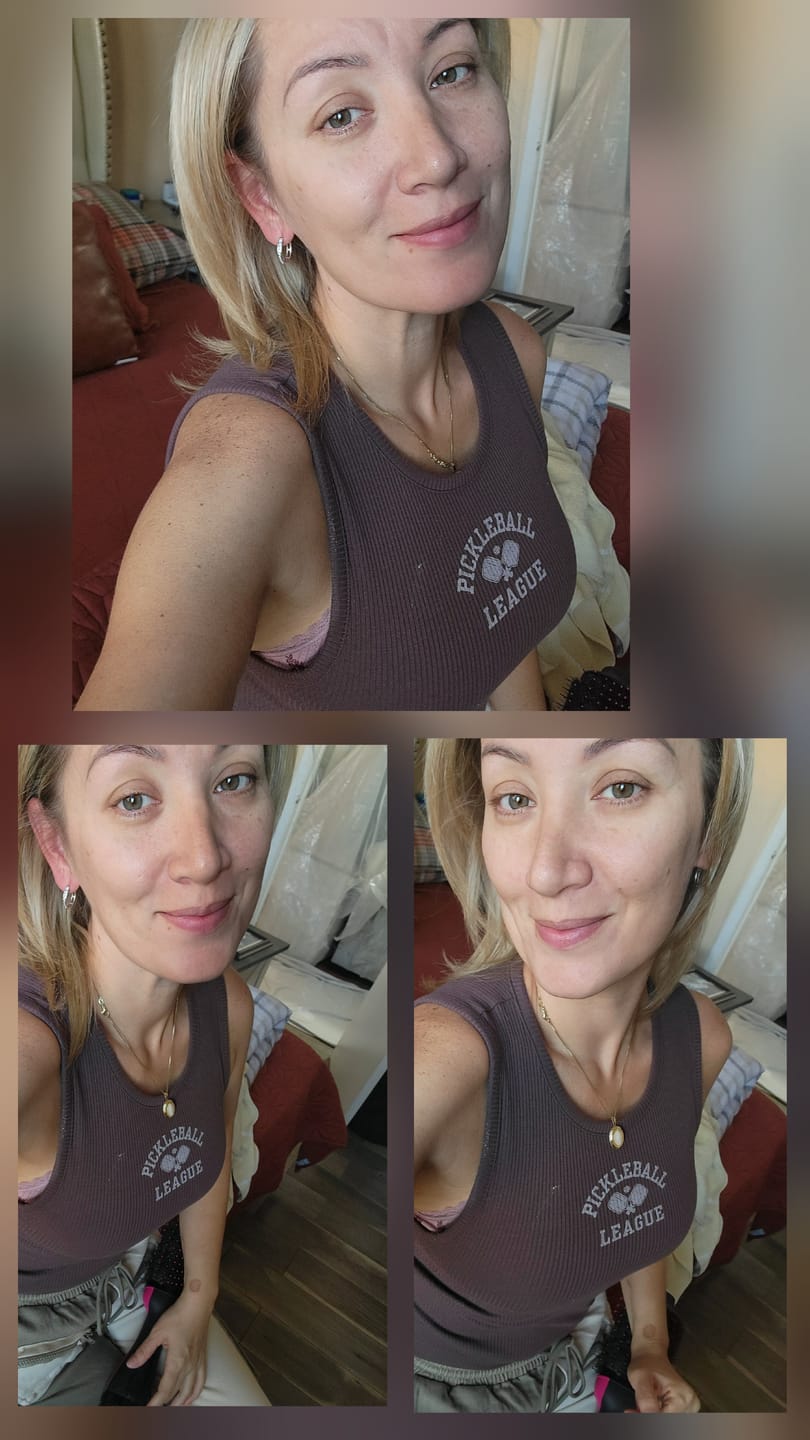 Customer photo review of INIA FLARE Microcurrent Facial Device
