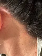 Customer photo review of Capilux™ — Exfoliante para un Cuero Cabelludo Limpio y Calmado