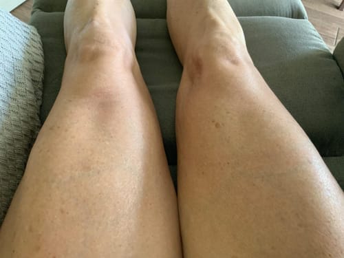 Customer photo review of NØRD BODY Peptide Body Oil t15