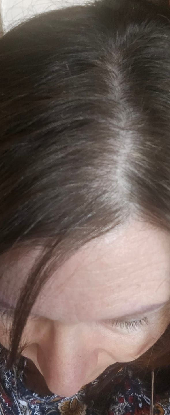 Customer photo review of Hair & Nail Capsules