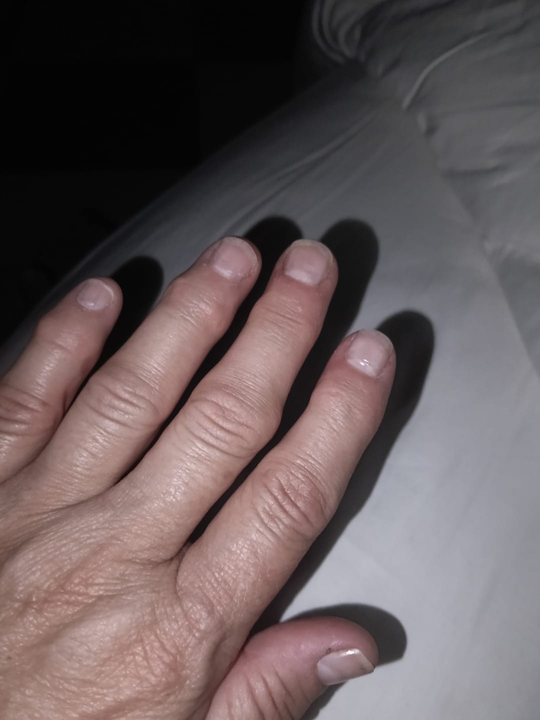 Customer photo review of Hair & Nail Capsules