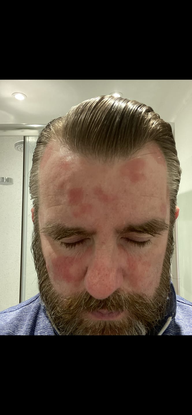 Customer photo review of Seb Natural Soothing Balm