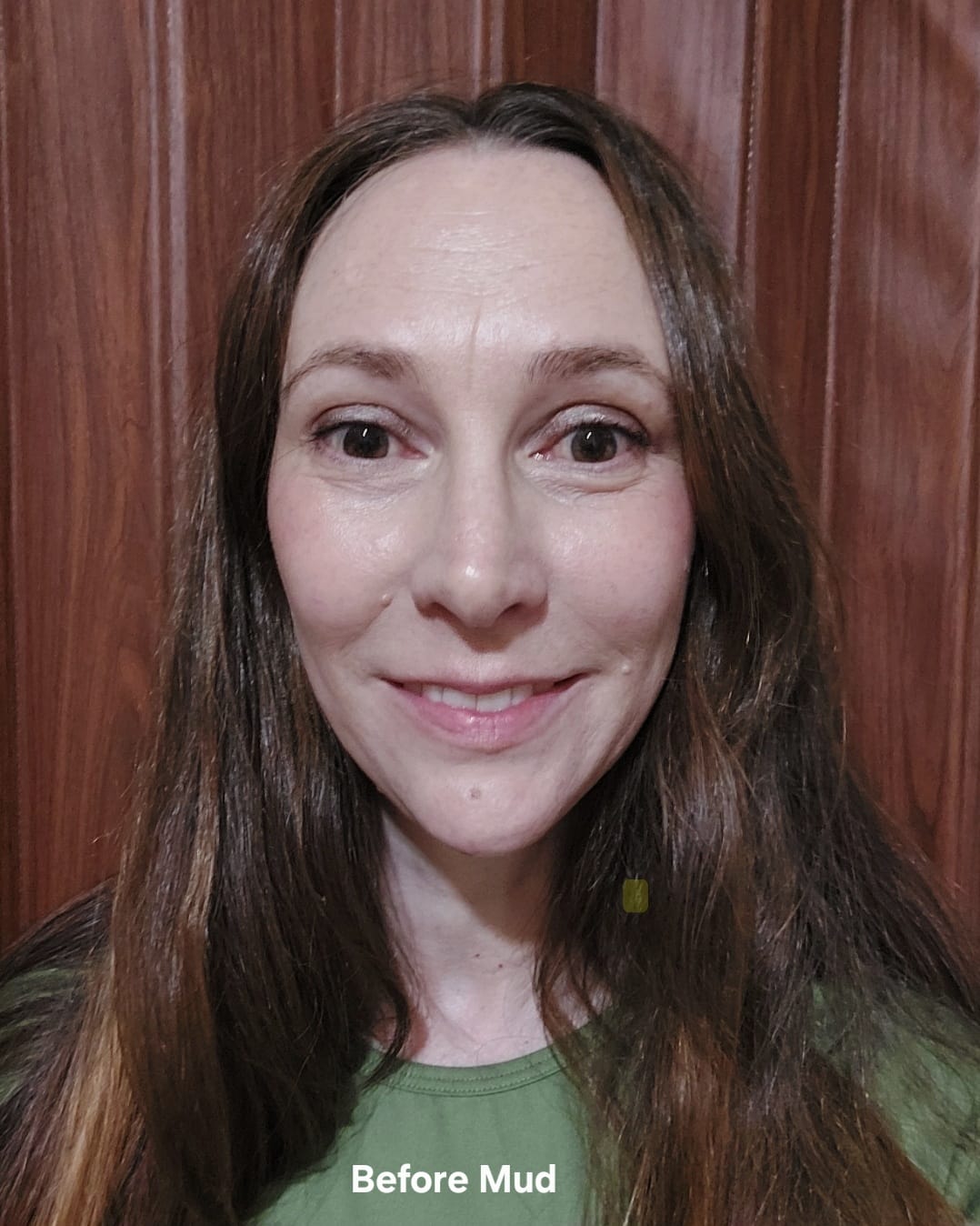 Customer photo review of Sea Buckthorn Serum - 30ml