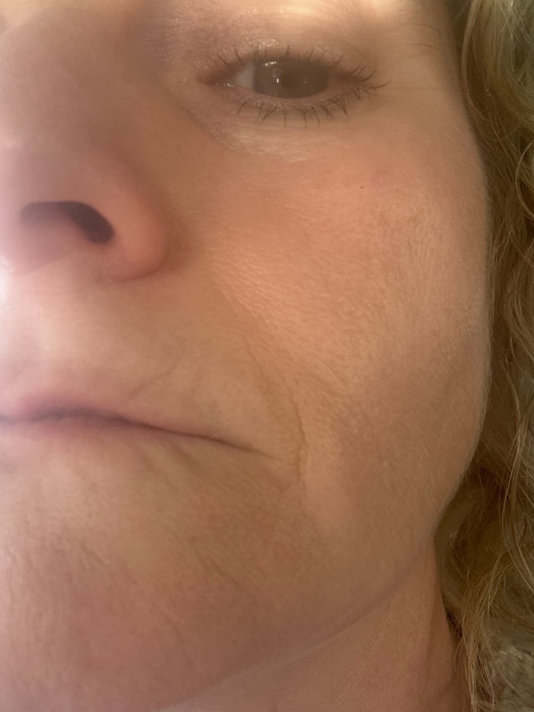 Customer photo review of Pro Age Set