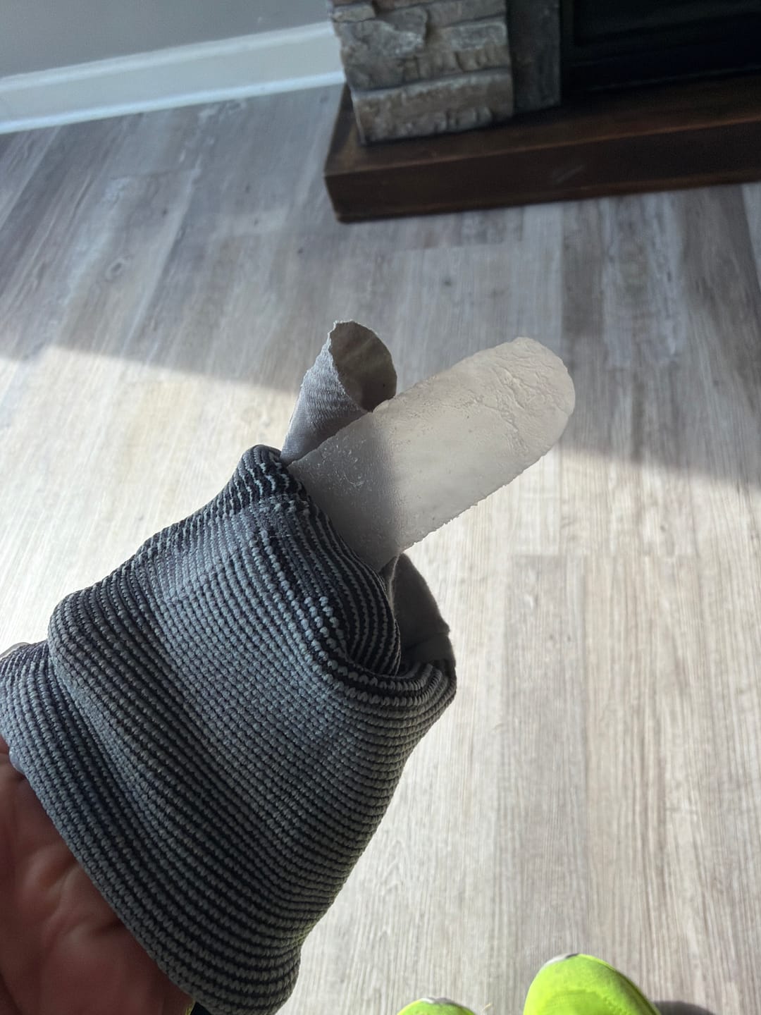 Customer photo review of Ankle Compression Supports