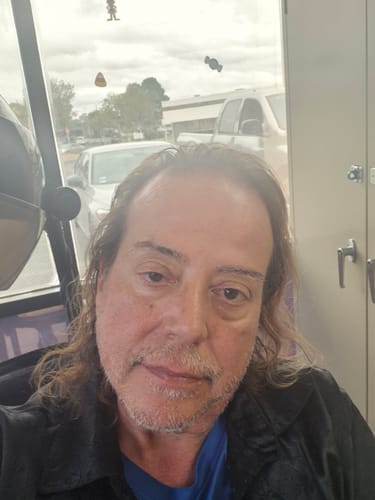 Reviewer's selfie, showing their skin after using the Seranova Micro Infusion System.
