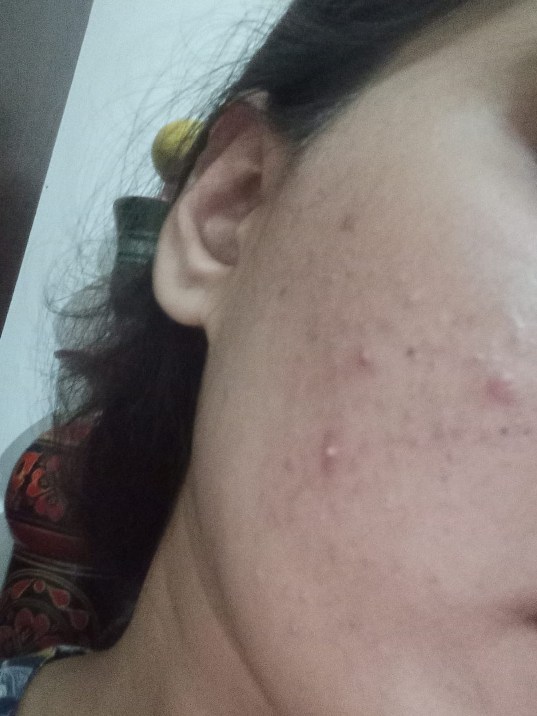 Customer photo review of Clear Veda Brightening Face Wash