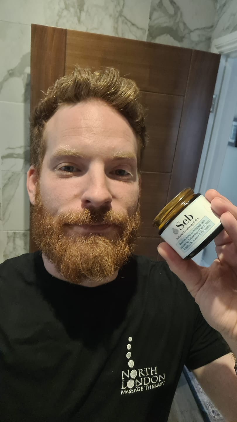 Customer photo review of Seb Natural Soothing Balm