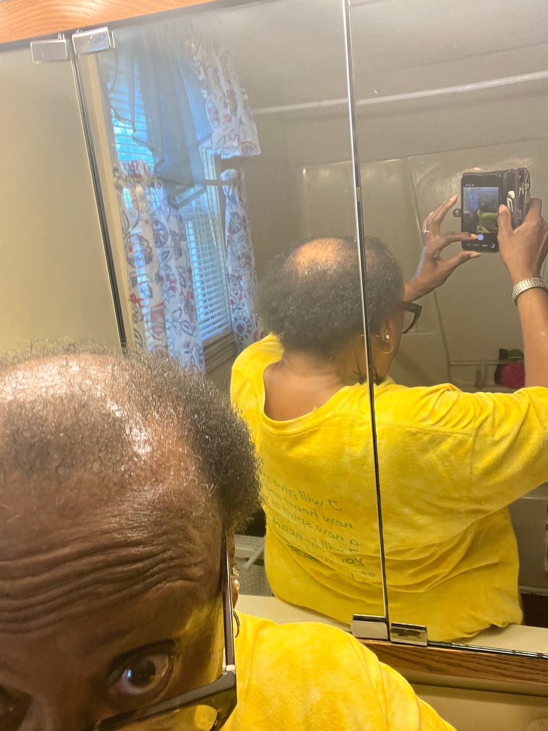 Customer photo review of Scalp Moisturizing Leave-In Treatment