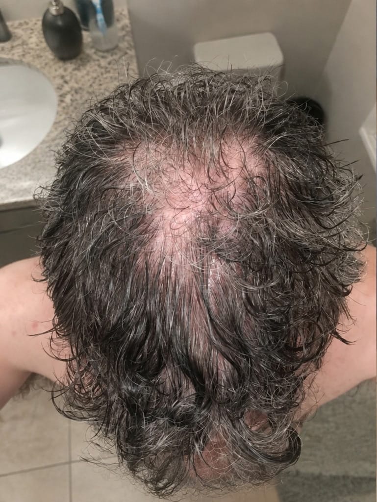 Customer photo review of Fundamental Hair Growth Kit | 4-in-1