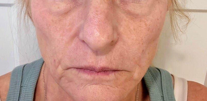 Customer photo review of ACTIVE PRO SERUM | ANTI-AGING