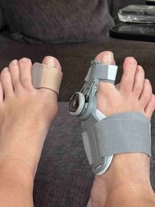 Customer photo review of Podiara™ Orteză Reglabilă Pentru Monturi