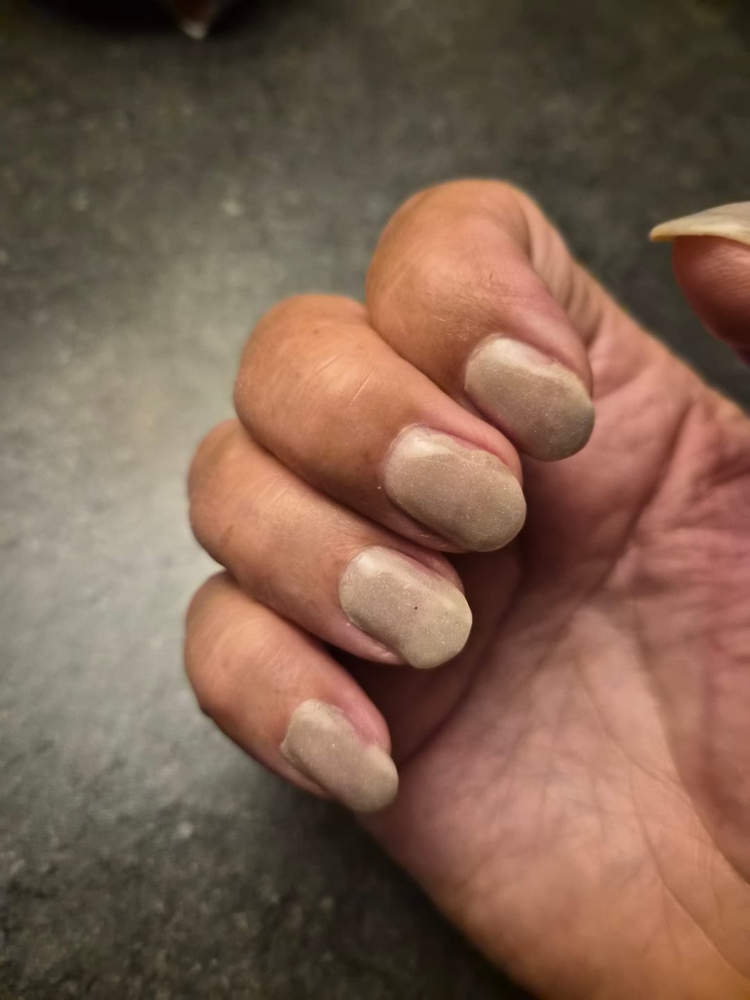 Customer photo review of Verzending Verzekering