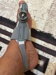Customer photo review of Podiara™ Orteză Reglabilă Pentru Monturi